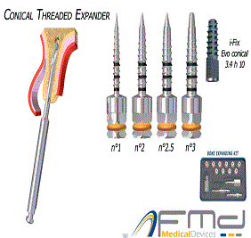 Sinus-T sinus lift technique for dental implants using DIO's specialist burrs and osteotome kit